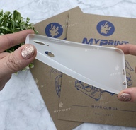 Чохол силіконовий для Huawei P20 Lite білий (4598) - фото 3 - Чохли для УФ друку