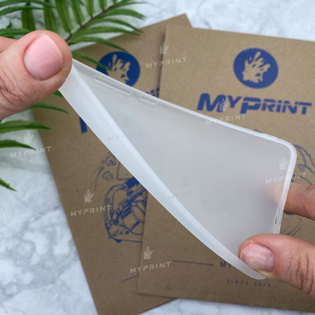 Чохол силіконовий для Xiaomi MI5s білий (5775) - фото 3 - Чохли для УФ друку