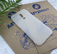 Чохол силіконовий для Meizu 16 Plus білий (4702) - фото 2 Чохол силіконовий для Meizu 16 Plus білий (4702) - фото 2 - Чохли для УФ друку