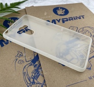 Чохол силіконовий для Xiaomi Redmi 4 білий (5786) - фото 3 - Чохли для УФ друку