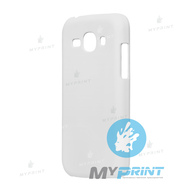 Cover for sublimation 3D plastic for Samsung Ace 3 Matte (3417) - фото 1 Cover for sublimation 3D plastic for Samsung Ace 3 Matte (3417) - фото 1 - Blanks for sublimation