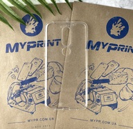 Чохол силіконовий для Nokia 6.1 plus (X6) прозорий (2715) - фото 1 Чохол силіконовий для Nokia 6.1 plus (X6) прозорий (2715) - фото 1 - Чохли для УФ друку