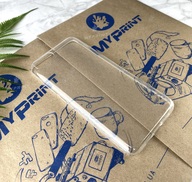 Transparent silicone case for Xiaomi MI6 (5095) - фото 2 Transparent silicone case for Xiaomi MI6 (5095) - фото 2 - Covers for UV printing