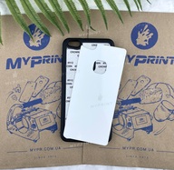 Чехол для сублимации 2D силиконовый (TPU) для Huawei P10 Lite черный (2435) - фото 1 Чехол для сублимации 2D силиконовый (TPU) для Huawei P10 Lite черный (2435) - фото 1 - Заготовки для сублимации